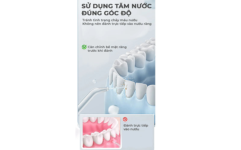 Máy tăm nước Magic Eco PRO-80 - Hàng chính hãng