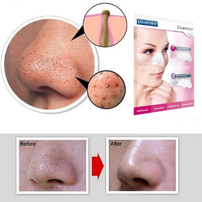 Miếng dán lột mụn và chăm sóc da Lanaform LA130207 - Hàng chính hãng